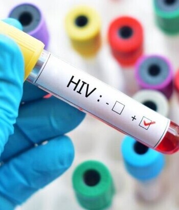 Të sëmurët me HIV dhe hepatit C janë më të rrezikuar për insuficiencë kardiake 
